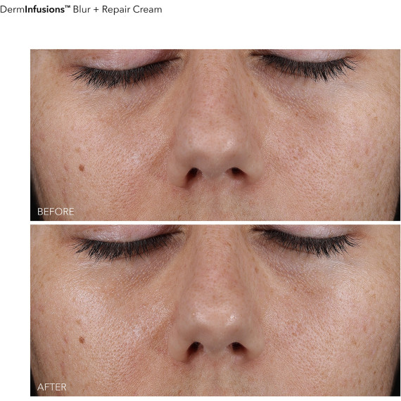 Dr. Gross DermInfusions Blur & Repair Cream