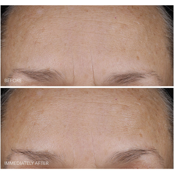 Dr. Gross DermInfusions Blur & Repair Cream