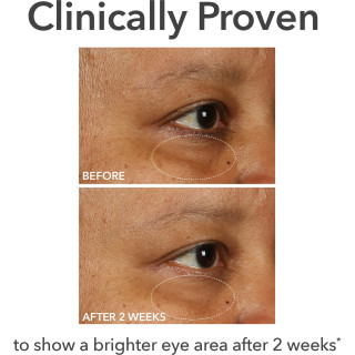 Dr. Gross DermInfusions Fill & Repair Eye Cream