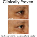 Dr. Gross DermInfusions Fill & Repair Eye Cream